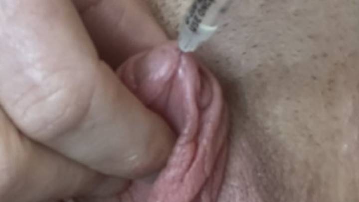 Injecting Saline into Clit