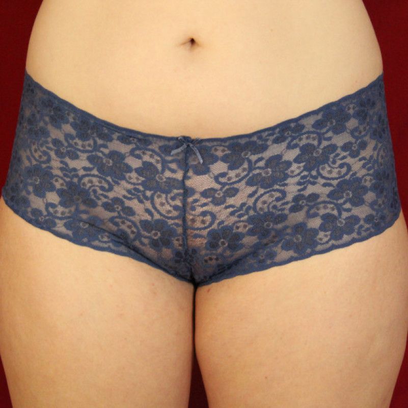 Dark Blue Lace Panties