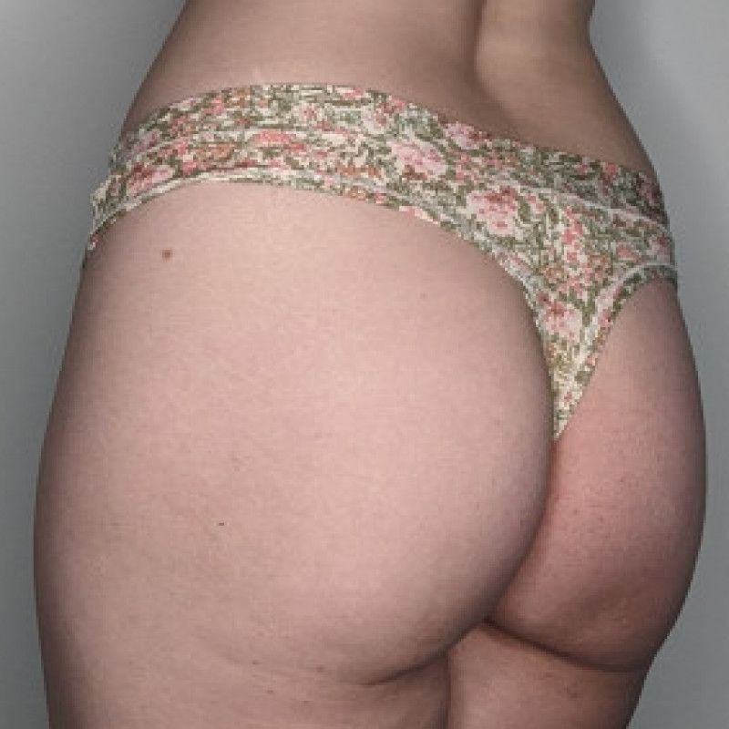 Floral Thong Panties