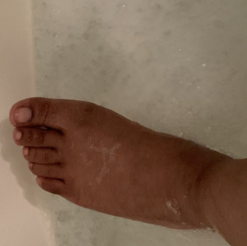 Melanin Feet