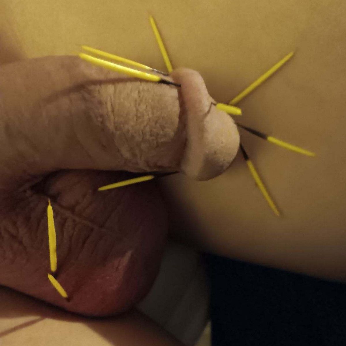 Penis Quills