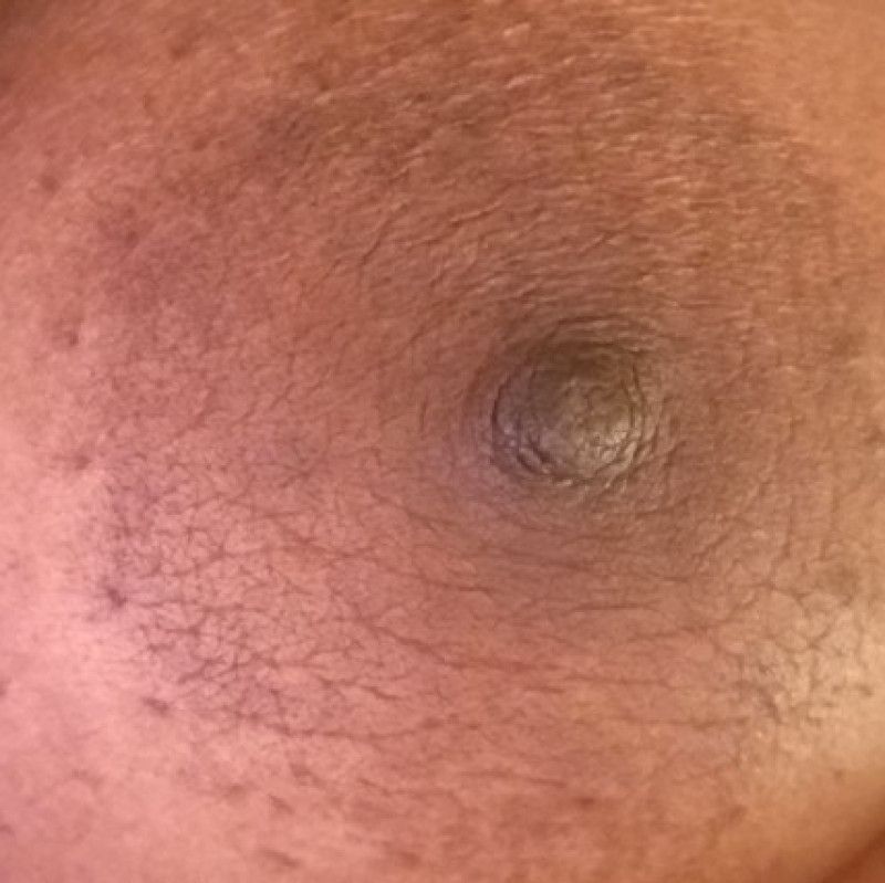 Up close and areola