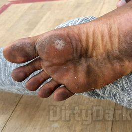 Ultra Filthy Feet at the Squash court