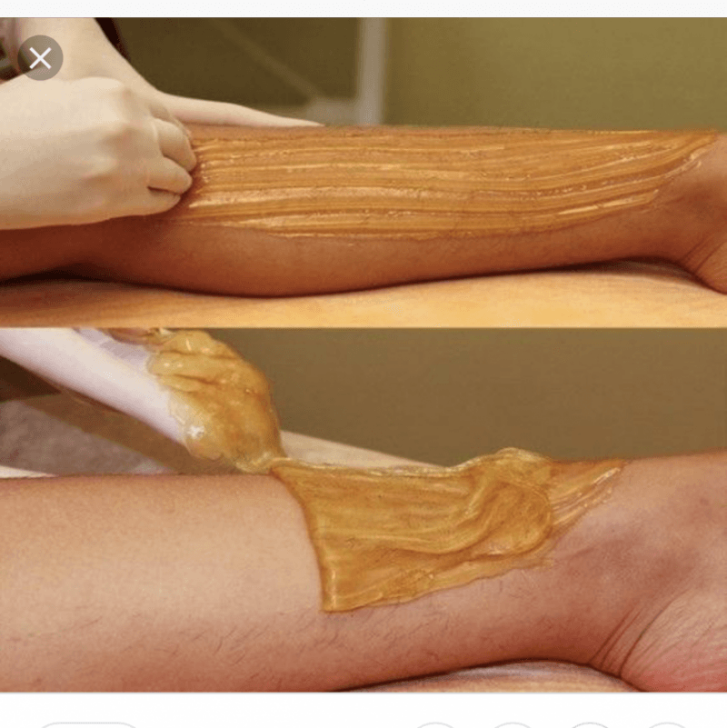 Permanent Hair Removal