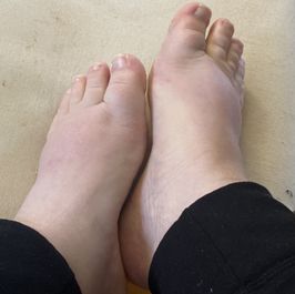 feet pics