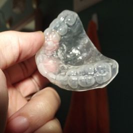 my used mouthguard