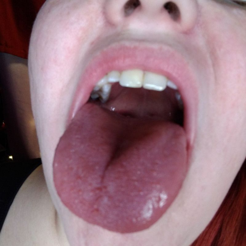 Tongue Photo Set