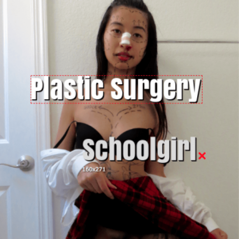 Plastic Surgery Schoolgirl Photoset