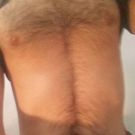 Hairy24