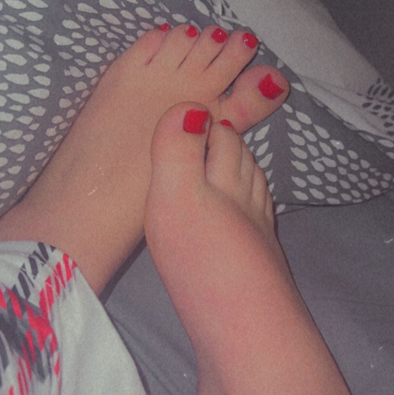 Red toes