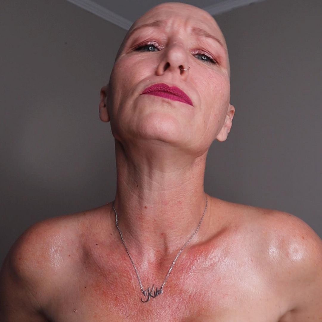 My Bald and Oily Photo Set