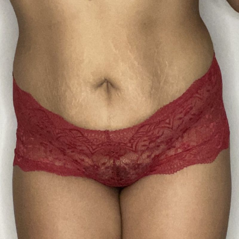 Red lace boy short