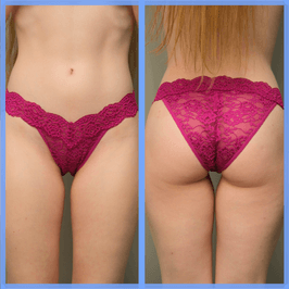 Magenta Lace Cheeky Panties