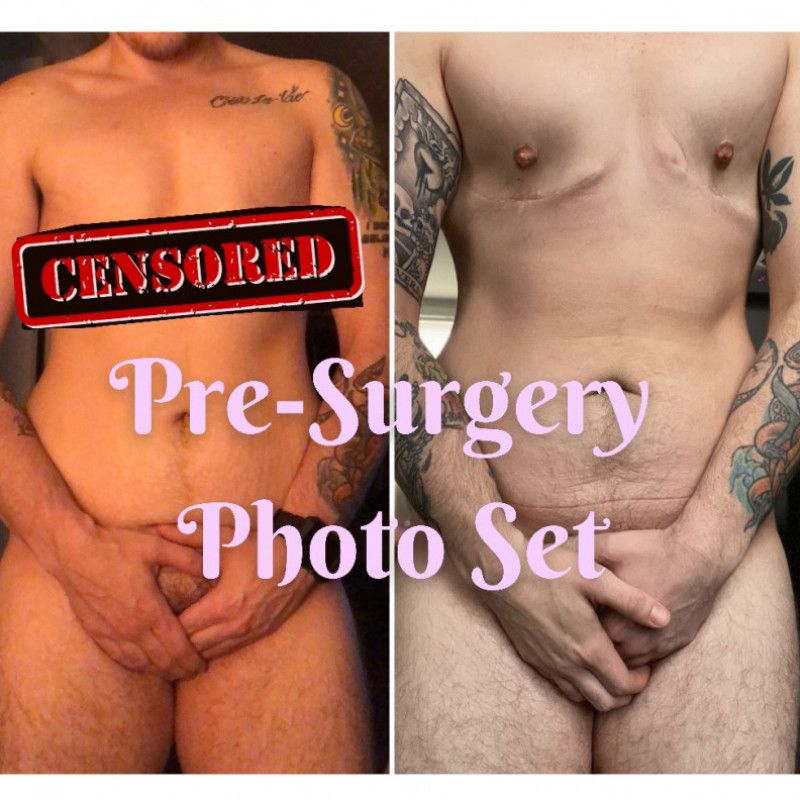 Before Surgery Photo Set