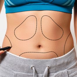 BYOB Vote Tummy Tuck  abdominoplasty