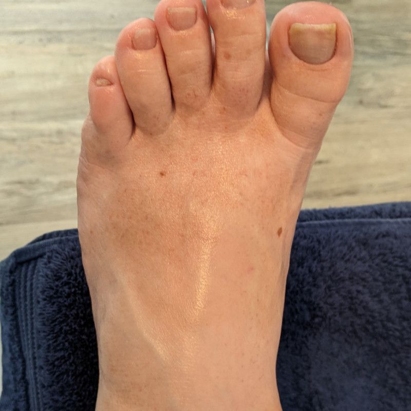 Freshly pedicured feet pics