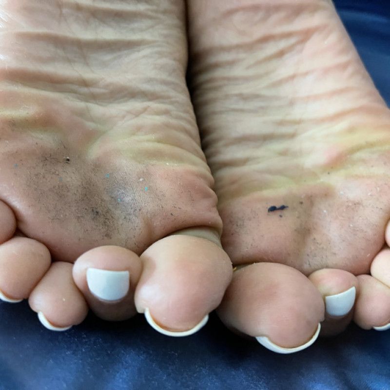 Dirty Feet with White Polish