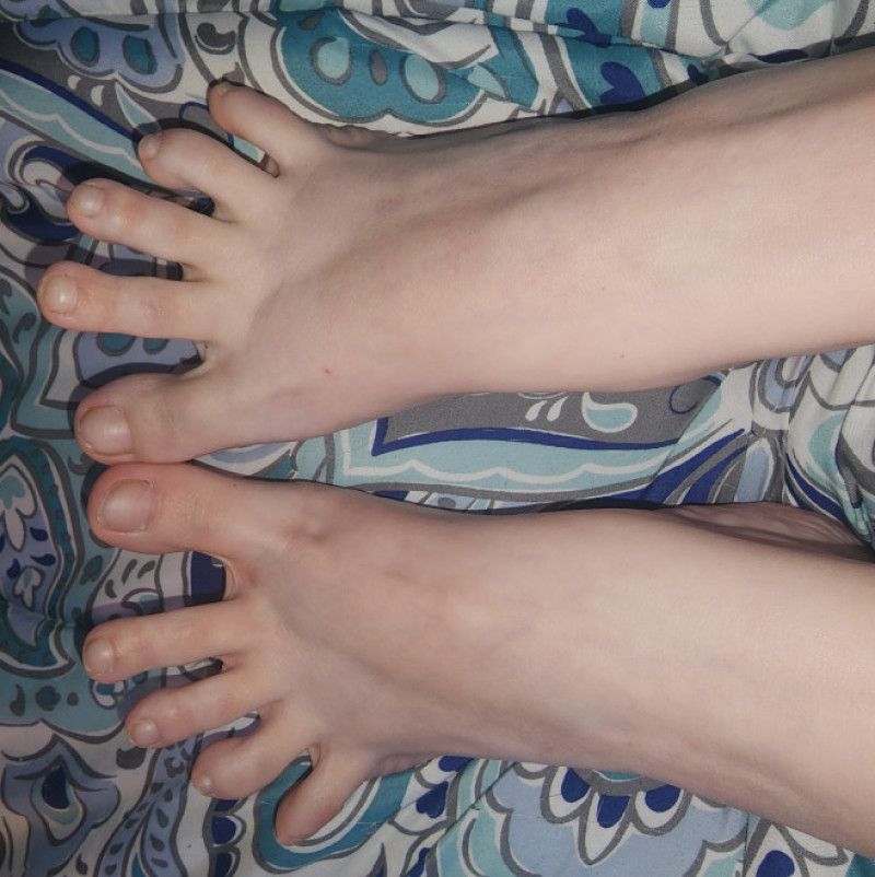 Feet at play