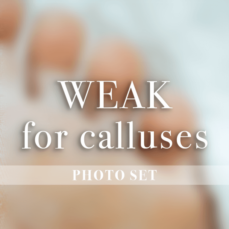 Weak for callusses