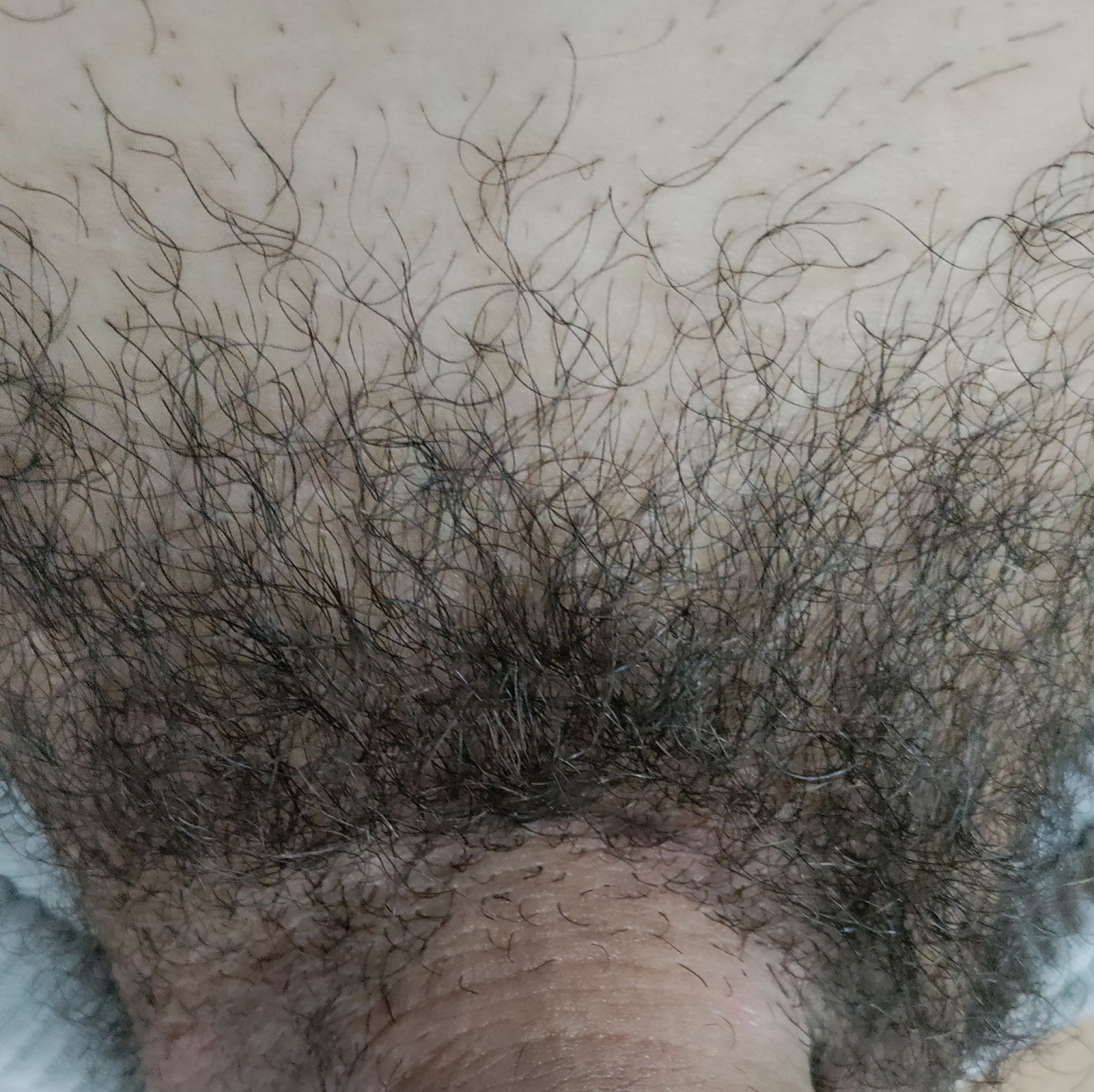 Pubes