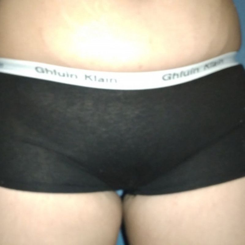 Torn black panties