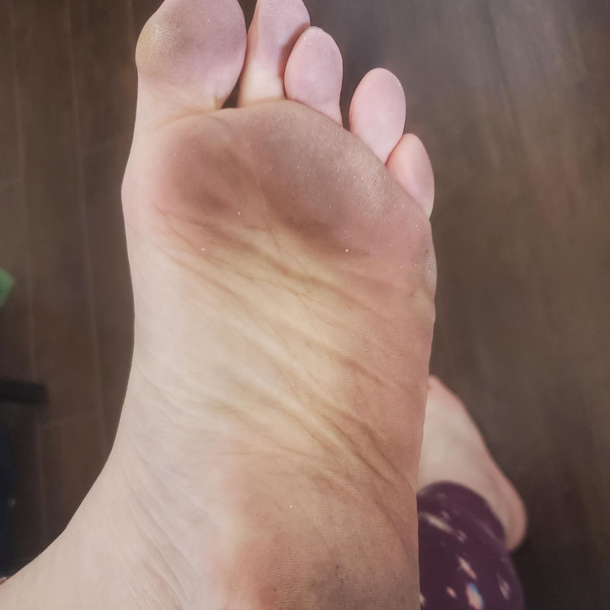 dirty or peeling feet pics