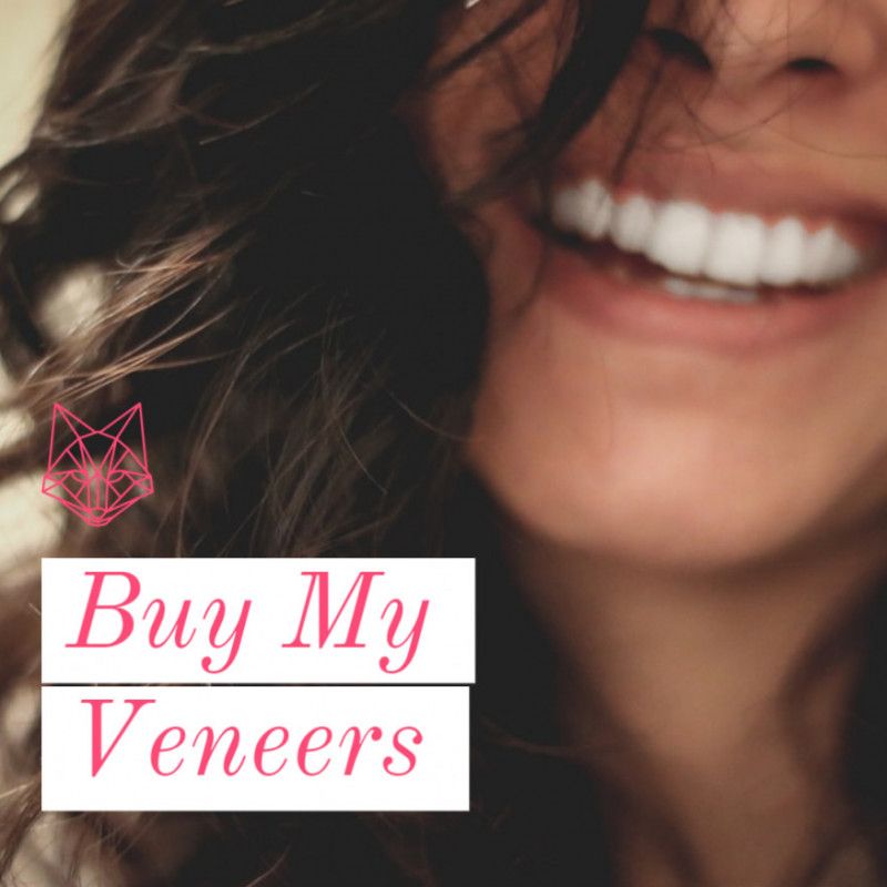 Veneers