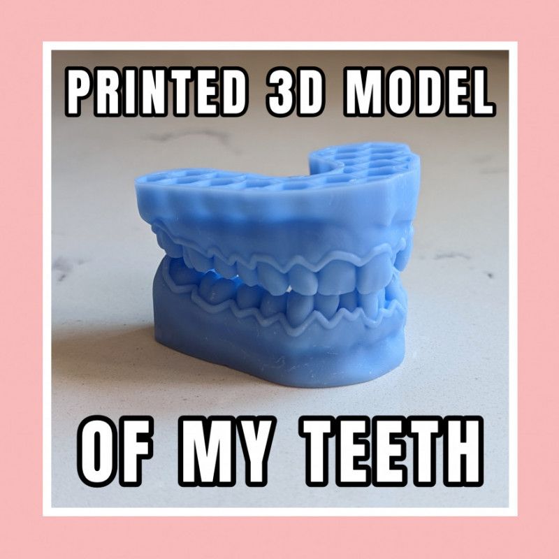 Printed 3D Model of My Teeth