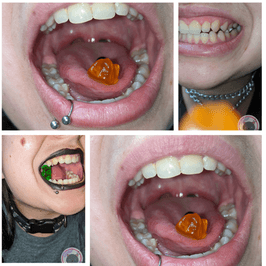 Massive set of mouth and throat pictures