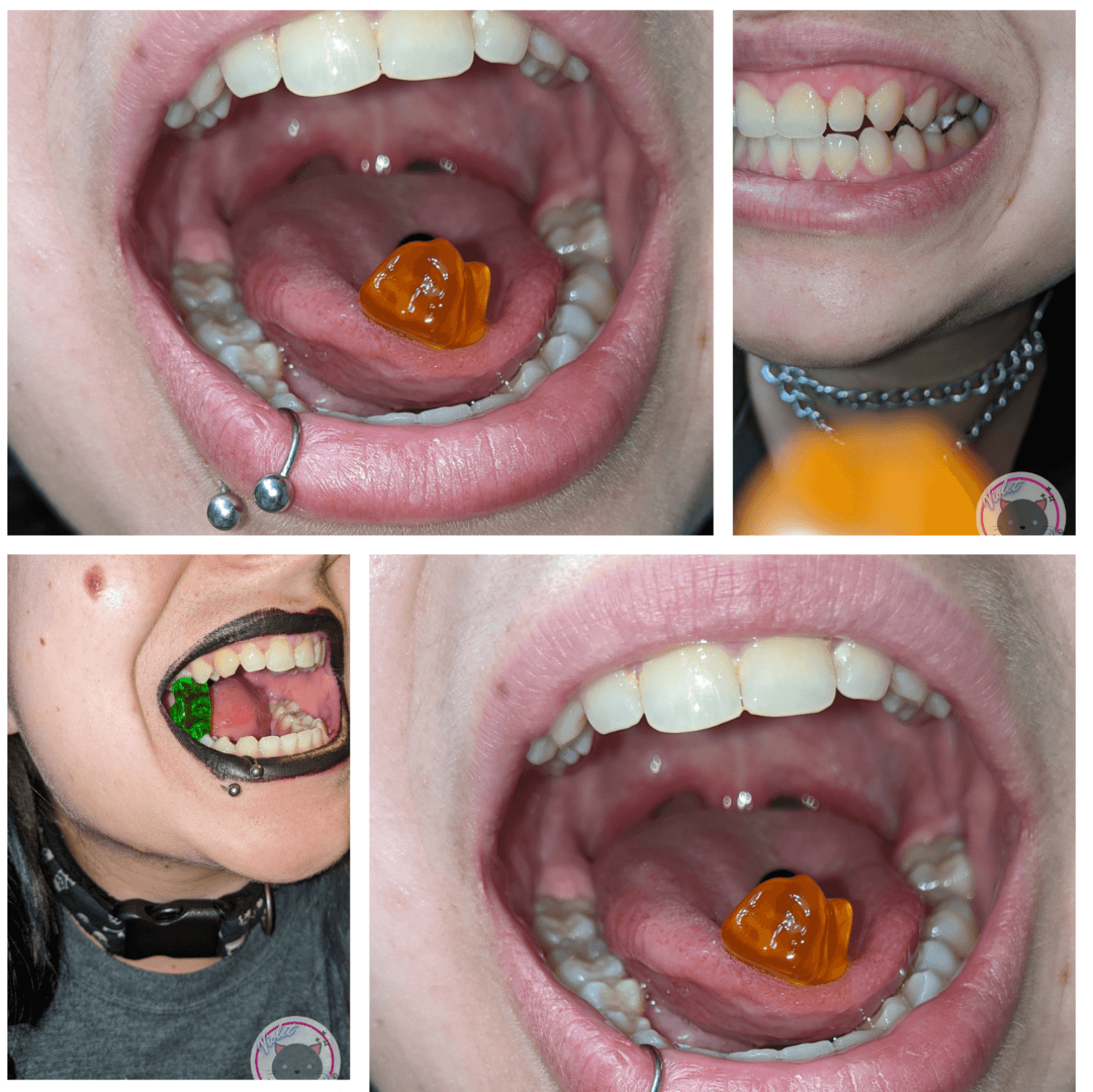 Massive set of mouth and throat pictures