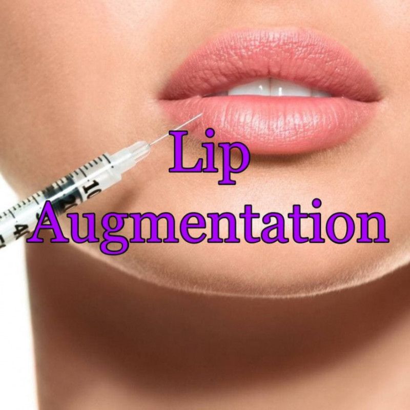 lip augmentation