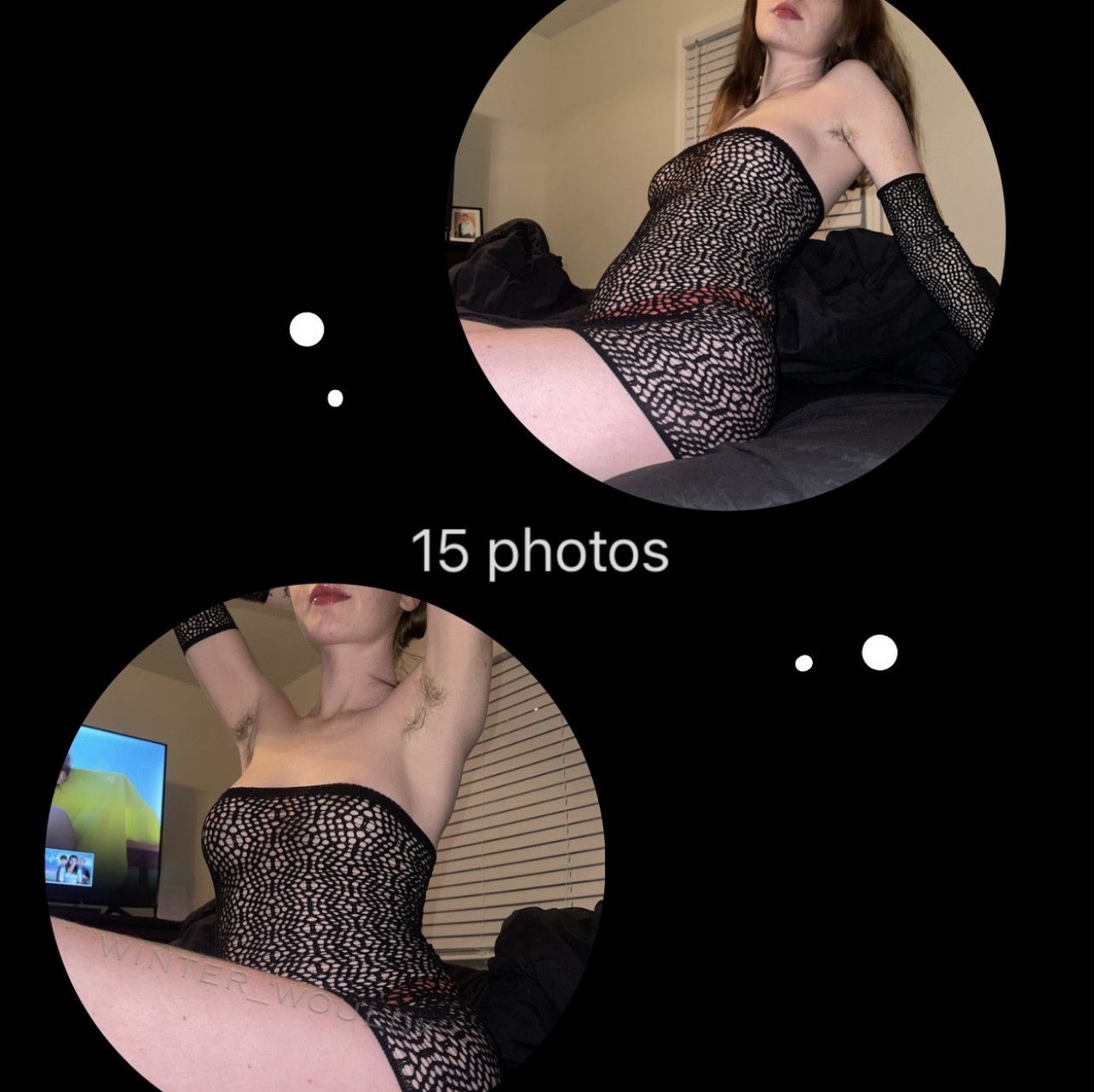 15 Photoset