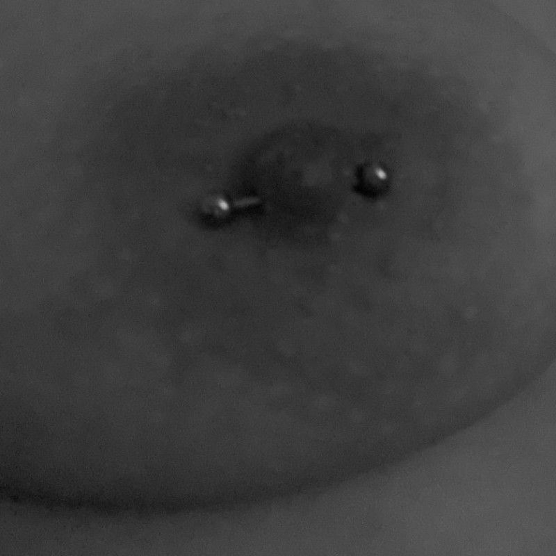 Nipple