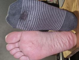 Dirty Sock