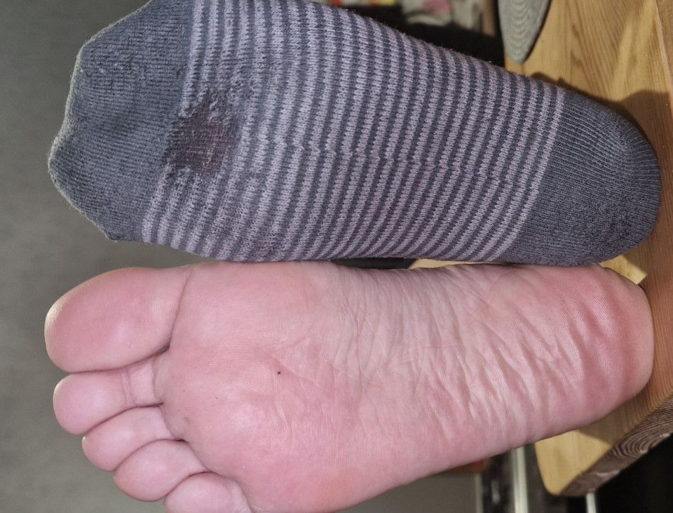 Dirty Sock