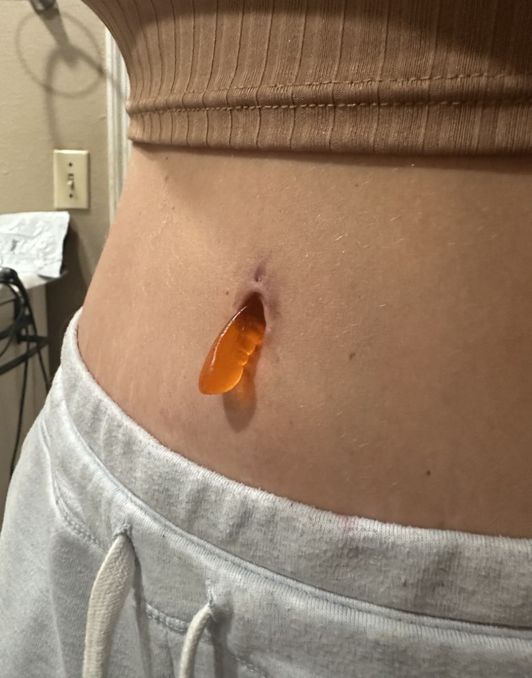 Bellybutton Candy