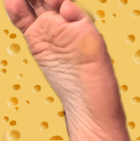 Cheese shredded from the calluses of my feet