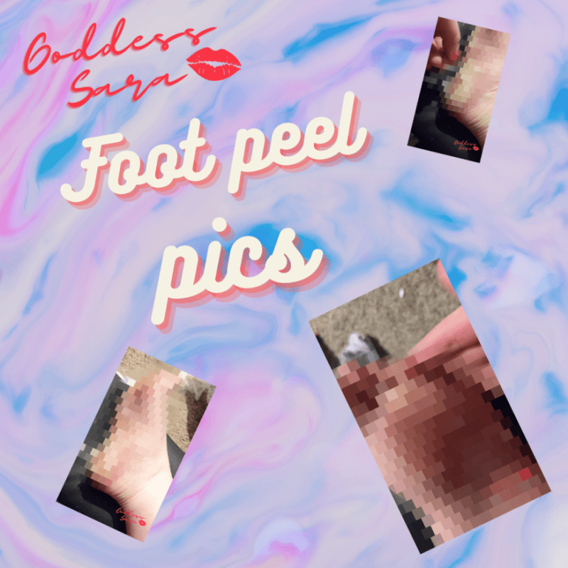 Foot Peel Photo Set