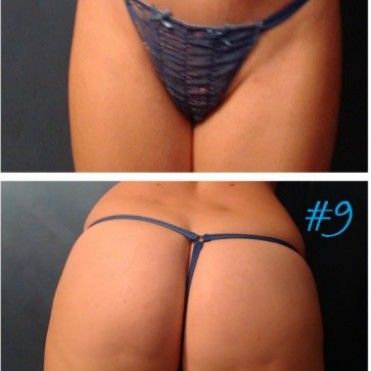 Blue Sparkle Gstring