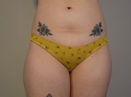 Yellow Panties with Flowers