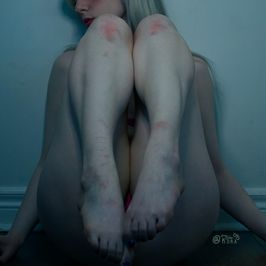 Barefoot and Bruised