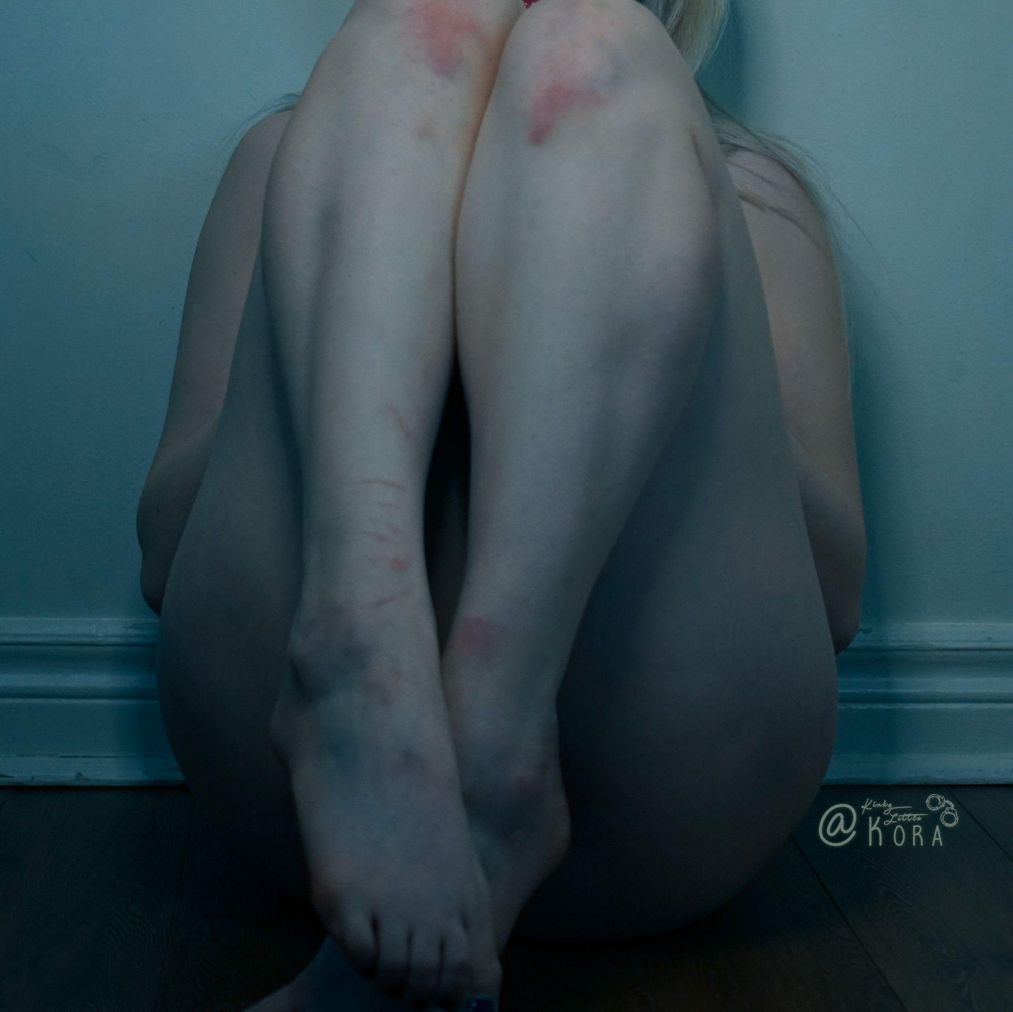 Barefoot and Bruised