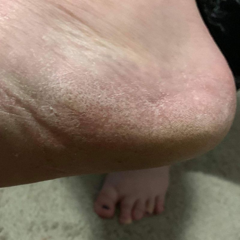 MXAmbrosias foot dust