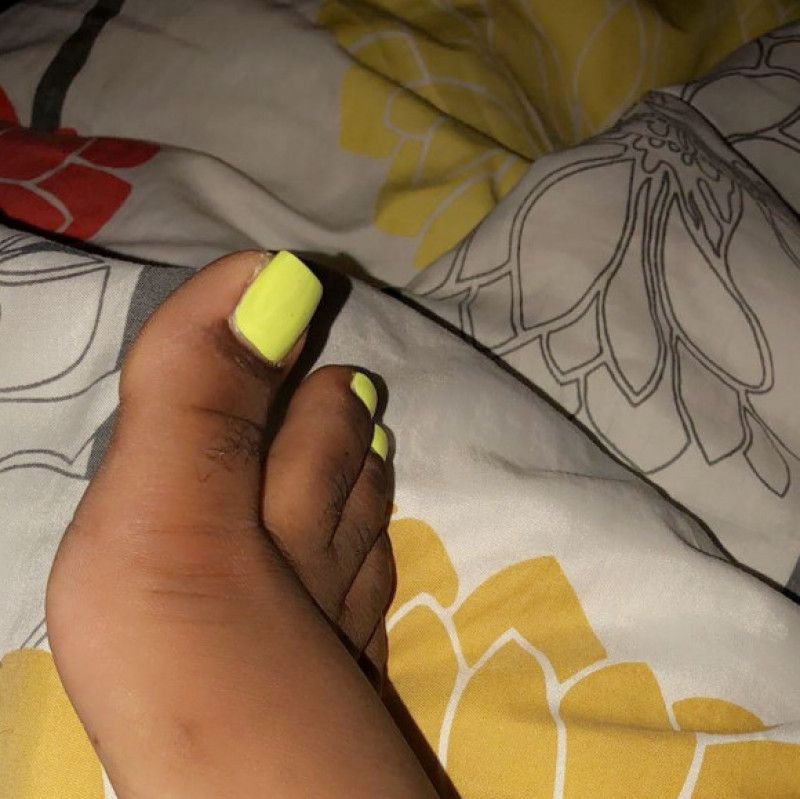 Neon toes