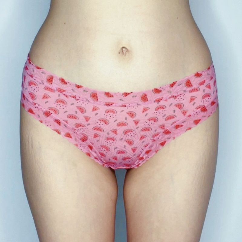 Watermelon panties