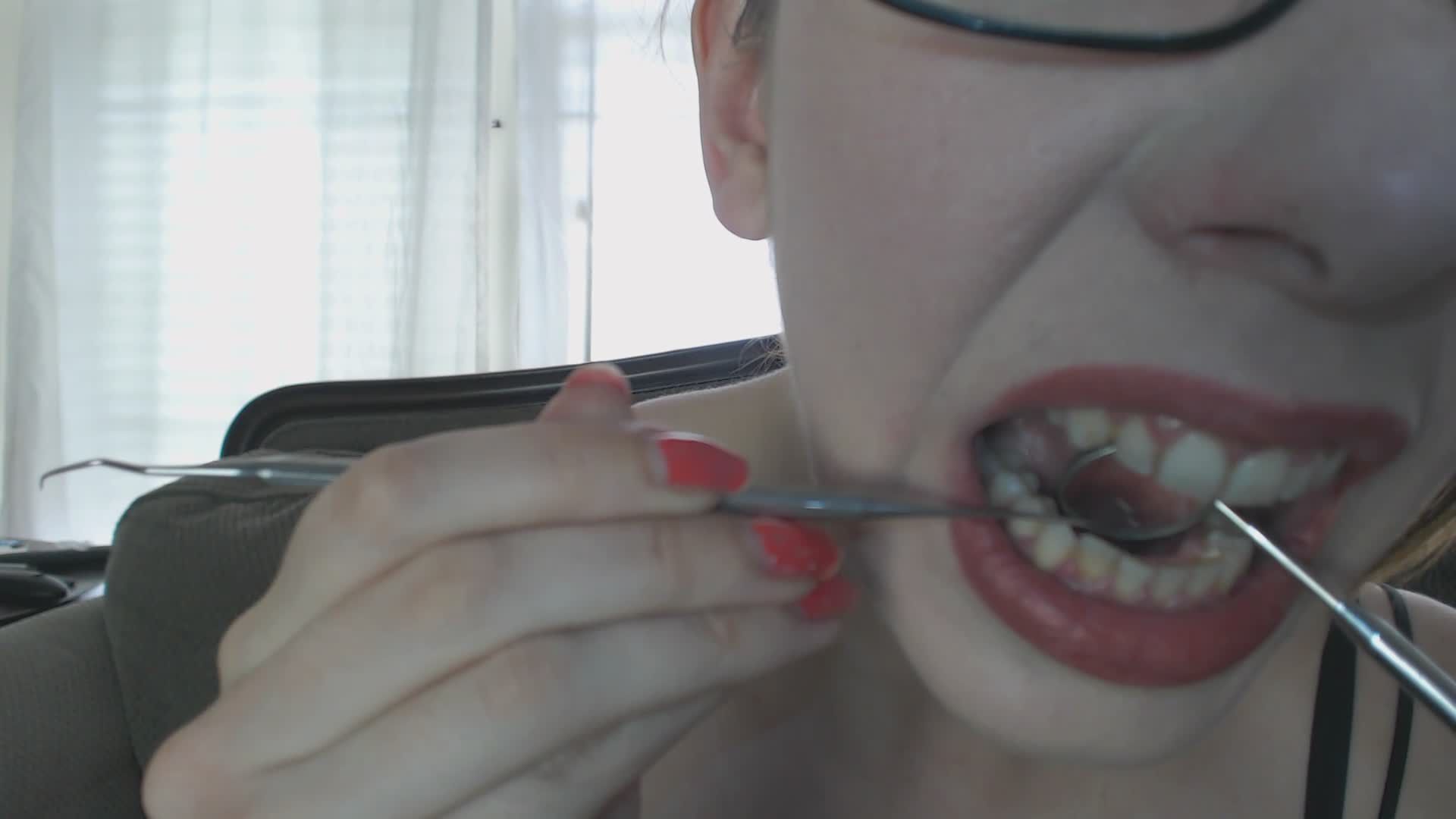 Sammy Scrapes Her Teeth With Dental Tool