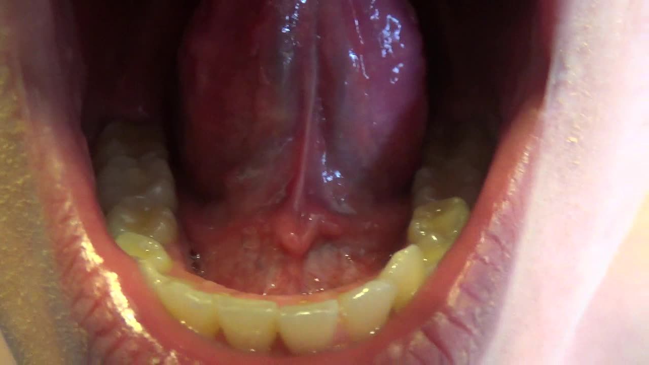 Mouth , throat, teeth , tongue and uvula