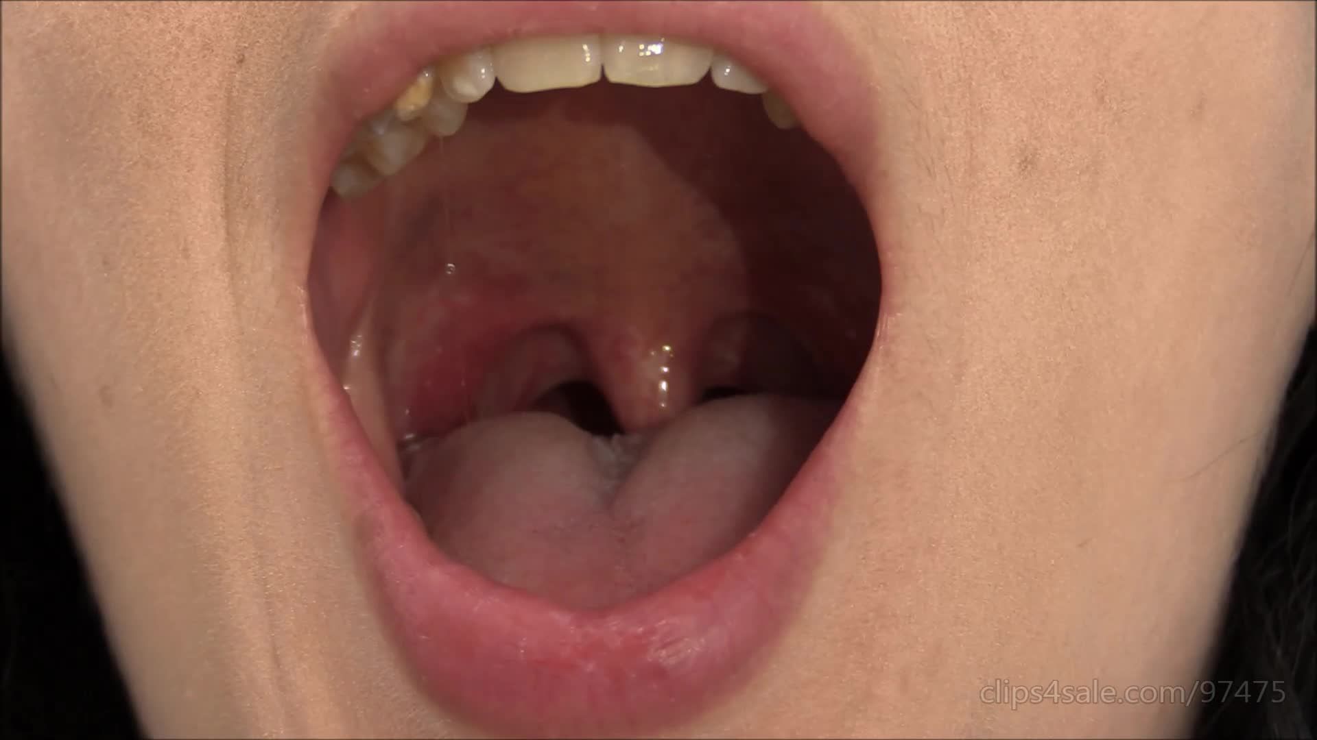 My uvula