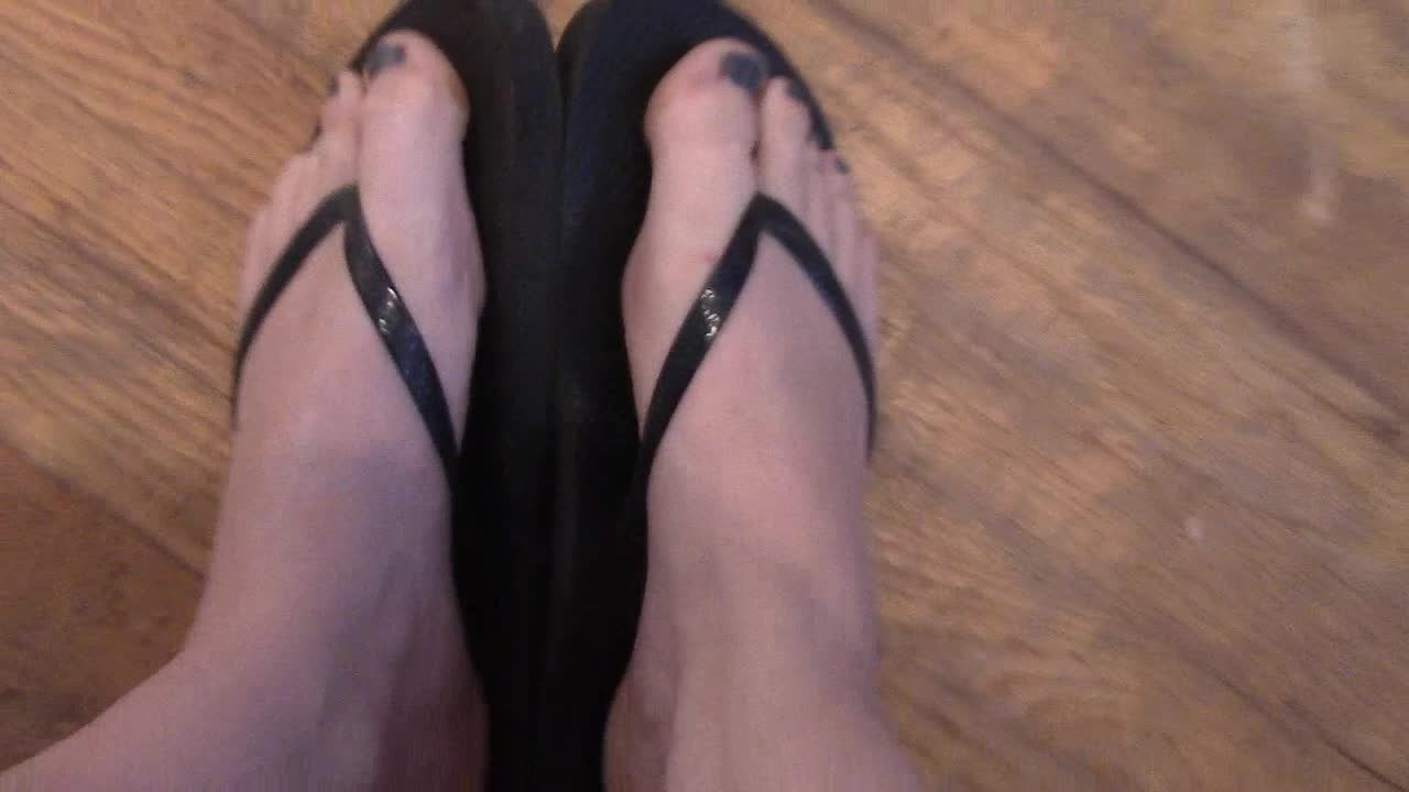 Bunions in Flip Flops