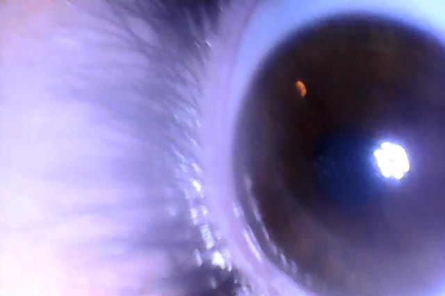 Eye fetish video with scope cam